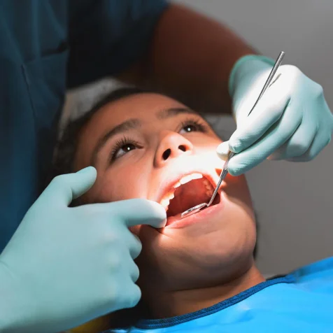 Dental Extractions